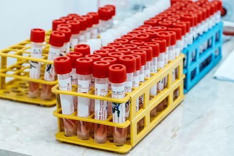 Stock image of COVID PCR test vials